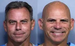 Attorney: Erik Menendez moved from jail to hospital due to ‘serious’ condition